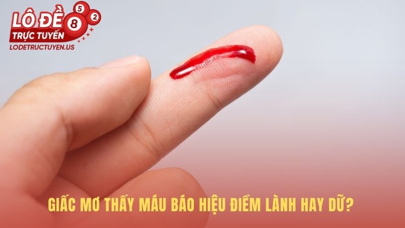 Mơ thấy máu mang ý nghĩa kép về điềm báo tốt và xấu